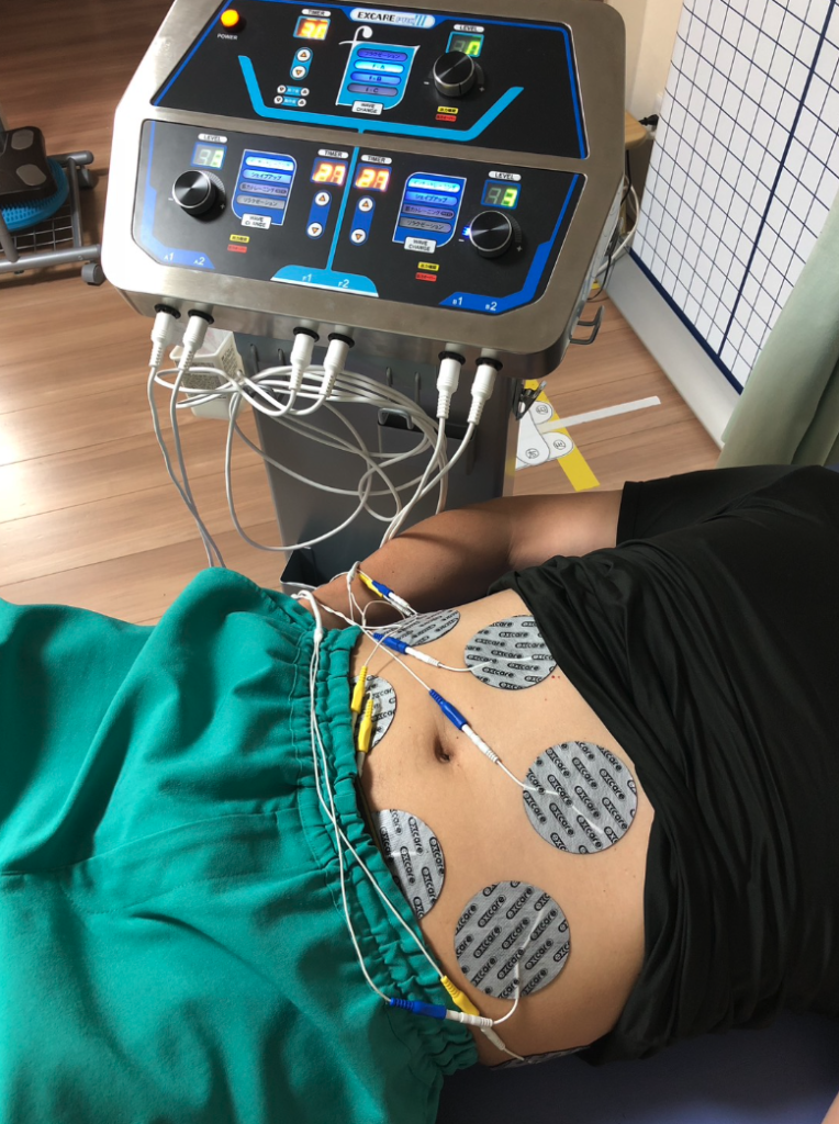腹部に電極パッドを装着した楽トレ（複合高周波EMS）の様子